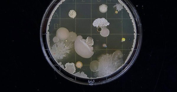 A petri dish covered in bacterial/fungal colonies growing on the agar in front of a black background