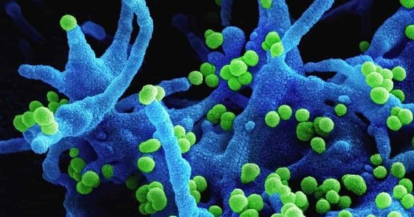 A false colored electron micrograph of lassa virus particles across infected tissue